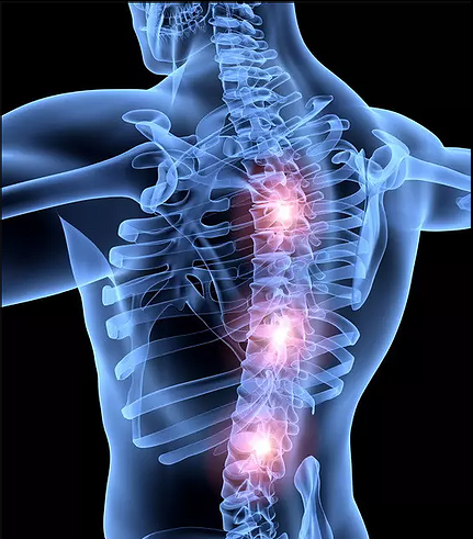 Degenerative Spine Conditions